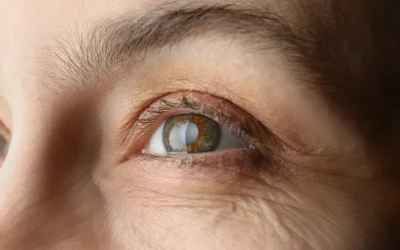 Early Signs of Cataracts You Might Mistake for Normal Aging